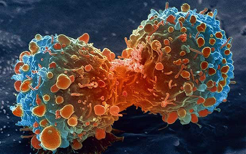 el-cancer